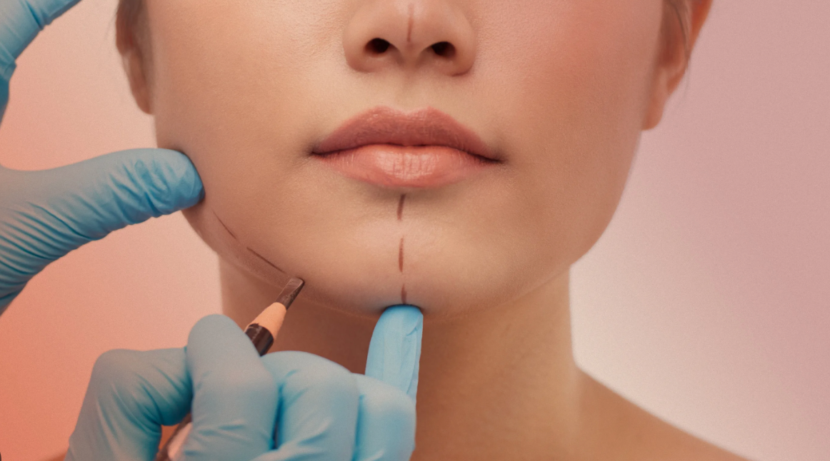 Deaths have increased among US patients who traveled to Dominican Republic  &hellip;